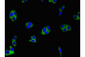 Immunofluorescent analysis of HepG2 cells using ABIN7147871 at dilution of 1:100 and Alexa Fluor 488-congugated AffiniPure Goat Anti-Rabbit IgG(H+L) (Claudin 1 antibody  (AA 24-161))