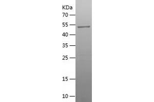 Raftlin Family Member 2 (RFTN2) (AA 201-479) protein (His-IF2DI Tag)