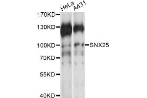 Western blot analysis of extracts of various cell lines, using SNX25 antibody (ABIN6291213) at 1:1000 dilution.