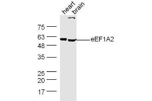 Mouse heart and brain lysates probed with Rabbit Anti-eEF1A1+2 Polyclonal Antibody, Unconjugated  at 1:500 for 90 min at 37˚C. (eEF1A1,2 (AA 1-100) antibody)