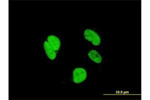 Immunofluorescence of monoclonal antibody to RAX on HeLa cell. (RAX antibody  (AA 104-206))