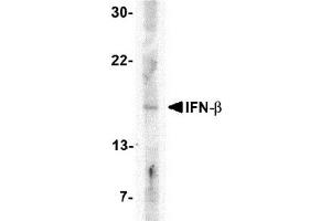 Western blot analysis of IFN-b in A-20 cell lysate with AP30401PU-N IFN-b antibody at 5 μg/ml. (IFNB1 antibody  (Center))