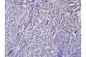 Paraformaldehyde-fixed, paraffin embedded Human kidney, Antigen retrieval by boiling in sodium citrate buffer (pH6. (IL1A antibody  (AA 151-220))