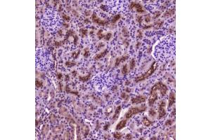 IHC testing of FFPE rat kidney tissue with PDGFRB antibody at 2 ug/ml. (PDGFRB antibody  (AA 911-992))