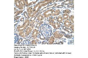 Human kidney (MCT3 antibody  (Middle Region))