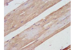 IHC image of ABIN7169503 diluted at 1:500 and staining in paraffin-embedded human skeletal muscle tissue performed on a Leica BondTM system. (SHARPIN antibody  (AA 82-171))