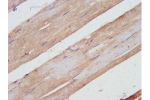 IHC image of ABIN7169503 diluted at 1:500 and staining in paraffin-embedded human skeletal muscle tissue performed on a Leica BondTM system.
