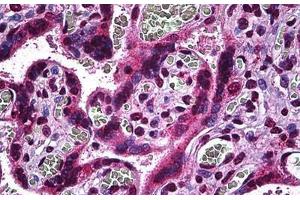 Human Placenta: Formalin-Fixed, Paraffin-Embedded (FFPE) (MAP2K3 antibody  (AA 1-100))