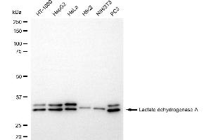 Western blotting analysis using lactate dehydrogenase A antibody (ABIN7799224).