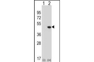 Western blot analysis of EIF4A2 (arrow) using rabbit polyclonal EIF4A2 Antibody (C-term) (ABIN653137 and ABIN2842713). (EIF4A2 antibody  (C-Term))