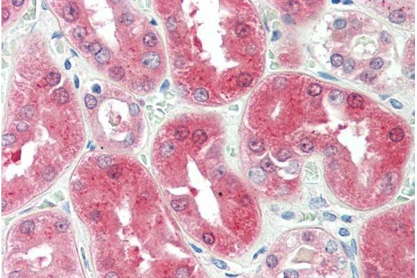 BDH2 antibody  (Internal Region)