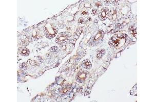 Immunohistochemistry (IHC) image for anti-Proprotein Convertase Subtilisin/kexin Type 9 (PCSK9) (AA 671-687) antibody (ABIN3032341)