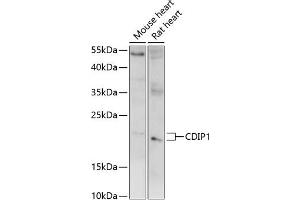 Western blot analysis of extracts of various cell lines, using CDIP1 antibody (ABIN7268288) at 1:1000 dilution. (CDIP1 antibody  (AA 100-200))