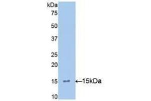 Detection of Recombinant IL15, Mouse using Polyclonal Antibody to Interleukin 15 (IL15) (IL-15 antibody  (AA 49-162))