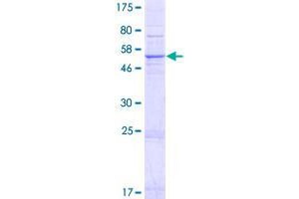 SRD5A3 Protein (AA 1-318) (GST tag)