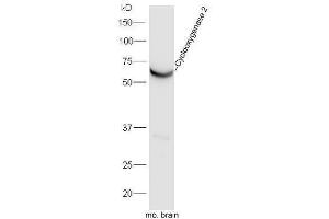 Mouse brain lysates probed with Rabbit Anti-Cyclooxygenase 2 Polyclonal Antibody, Unconjugated  at 1:5000 for 90 min at 37˚C. (PTGS2 antibody  (AA 501-604))