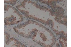 IHC-P analysis of Human Prostate Gland Tissue, with DAB staining. (CX3CL1 antibody  (AA 25-332))