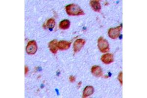 Immunohistochemical analysis of EPHA6 staining in human brain formalin fixed paraffin embedded tissue section. (EPH Receptor A6 antibody  (C-Term))