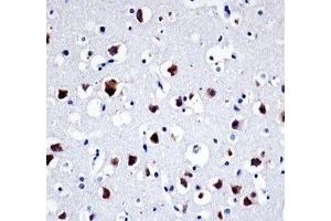 Src antibody immunohistochemistry analysis in formalin fixed and paraffin embedded human brain tissue (Src antibody  (AA 24-52))