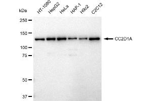 Western blotting analysis using CC2D1A antibody (ABIN7798112). (Recombinant CC2D1A antibody)