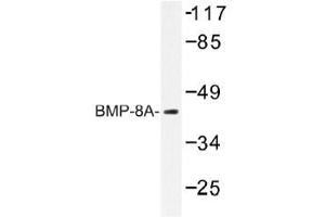 Image no. 1 for anti-Bone Morphogenetic Protein 8A (BMP8A) antibody (ABIN317821) (BMP8A antibody)