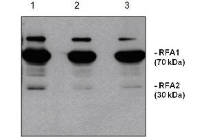 Western Blotting (WB) image for anti-Replication Protein A1, 70kDa (RPA1) antibody (ABIN190714) (RPA1 antibody)
