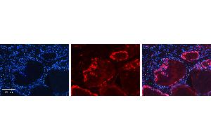 Rabbit Anti-MINA Antibody   Formalin Fixed Paraffin Embedded Tissue: Human Thyroid Tissue Observed Staining: Cytoplasm in follicular cells Primary Antibody Concentration: 1:100 Other Working Concentrations: N/A Secondary Antibody: Donkey anti-Rabbit-Cy3 Secondary Antibody Concentration: 1:200 Magnification: 20X Exposure Time: 0. (MINA antibody  (N-Term))