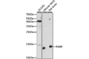 Western blot analysis of extracts of various cell lines, using RABIF antibody (ABIN7269786) at 1:1000 dilution. (RABIF antibody  (AA 1-123))