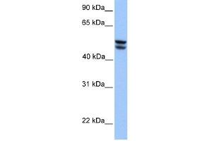 WB Suggested Anti-OXCT1 Antibody Titration:  0. (OXCT1 antibody  (Middle Region))
