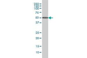 HERPUD1 monoclonal antibody (M04), clone 2G7 Western Blot analysis of HERPUD1 expression in HepG2 . (HERPUD1 antibody  (AA 74-180))