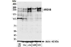 Western Blotting (WB) image for anti-AT Rich Interactive Domain 1B (SWI1-Like) (ARID1B) (AA 1425-1475) antibody (ABIN7795694)