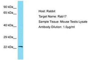 Image no. 1 for anti-RAB17, Member RAS Oncogene Family (RAB17) (AA 63-112) antibody (ABIN6750391) (RAB17 antibody  (AA 63-112))