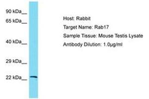 Image no. 1 for anti-RAB17, Member RAS Oncogene Family (RAB17) (AA 63-112) antibody (ABIN6750391) (RAB17 antibody  (AA 63-112))