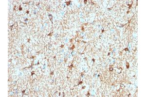 Formalin-fixed, paraffin-embedded human Cerebellum stained with GFAP Rabbit Recombinant Monoclonal Antibody (ASTRO/1974R). (Recombinant GFAP antibody)