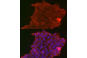 Immunofluorescence analysis of A-431 cells using PIGR Rabbit pAb (ABIN6128562, ABIN6145618, ABIN6145620 and ABIN6221728) at dilution of 1:150 (40x lens).