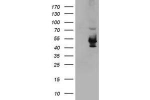 Western Blotting (WB) image for anti-Potassium Voltage-Gated Channel, Shaker-Related Subfamily, beta Member 1 (KCNAB1) antibody (ABIN1498999) (KCNAB1 antibody)