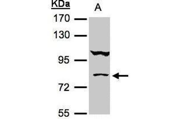 CALCOCO1 anticorps