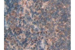 Detection of LOX1 in Rat Spleen Tissue using Polyclonal Antibody to Lectin Like Oxidized Low Density Lipoprotein Receptor 1 (LOX1) (OLR1 antibody  (AA 51-314))