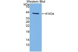 Detection of Recombinant TFR2, Human using Polyclonal Antibody to Transferrin Receptor 2 (TFR2)