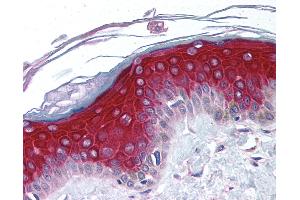 Anti-RPS6KA1 / RSK1 antibody IHC of human skin.