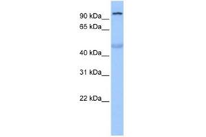 WB Suggested Anti-TULP3 Antibody Titration:  0.