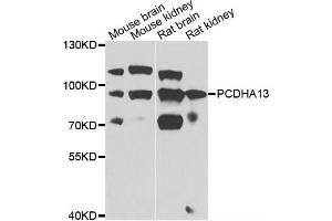 Western blot analysis of extracts of various cell lines, using PCDHA13 antibody (ABIN4904701) at 1:1000 dilution. (PCDHa13 antibody)