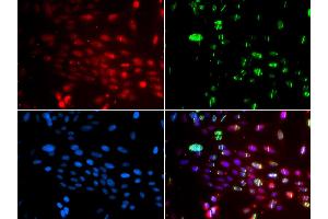 Immunofluorescence analysis of GFP-RNF168 transgenic U2OS cell using L3MBTL1 antibody. (L3MBTL1 antibody)