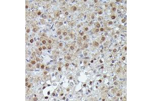 Immunohistochemistry of paraffin-embedded human esophagus using S100 Rabbit pAb (ABIN3015803, ABIN3015804, ABIN3015805, ABIN1682607 and ABIN6219148) at dilution of 1:100 (40x lens). (S100A10 antibody  (AA 1-97))