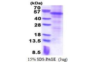 SDS-PAGE (SDS) image for Parkinson Protein 2, E3 Ubiquitin Protein Ligase (Parkin) (PARK2) (AA 1-465) protein (His tag) (ABIN5853490) (Parkin Protein (AA 1-465) (His tag))