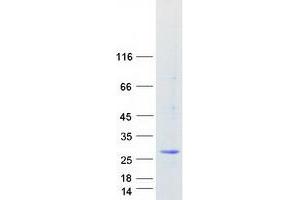 Western Blotting (WB) image for Mediator Complex Subunit 20 (MED20) protein (Myc-DYKDDDDK Tag) (ABIN2725738)