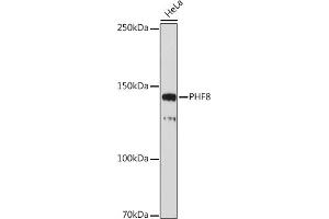 Western blot analysis of extracts of HeLa cells, using PHF8 antibody (ABIN7269263) at 1:1000 dilution. (PHF8 antibody)