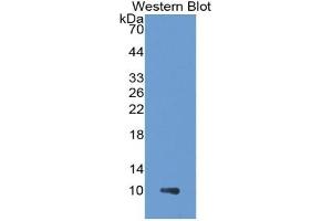 WB of Protein Standard: different control antibodies against Highly purified E. (CUL9 CLIA Kit)