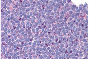 Human Tonsil: Formalin-Fixed, Paraffin-Embedded (FFPE) (SIP1 antibody  (C-Term))