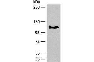 Western blot analysis of PC-3 cell lysate using GARNL3 Polyclonal Antibody at dilution of 1:400